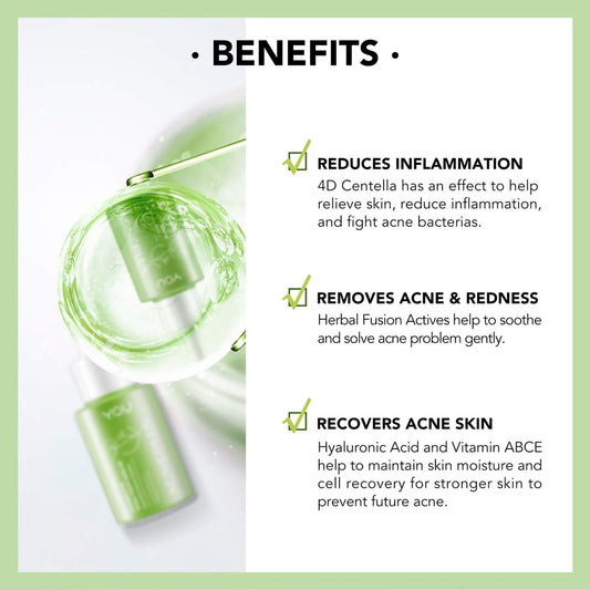 Y.O.U ,  Acne Plus Complete Solution Serum , 20 ML